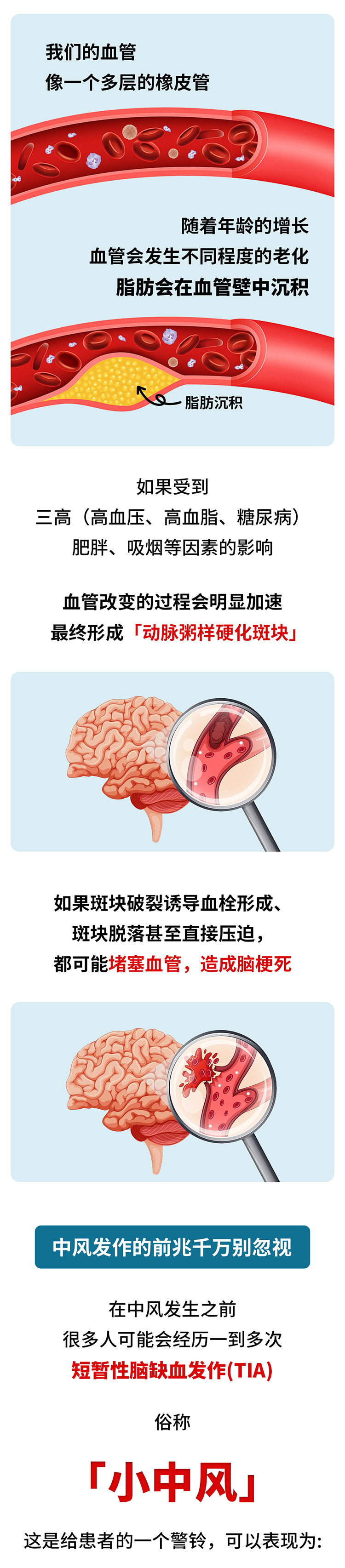 中風的5個前兆，盡早發(fā)現(xiàn)能救命_02.jpg